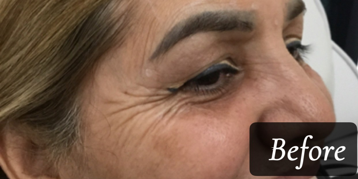 Before treatment