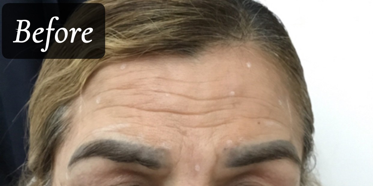 Before treatment
