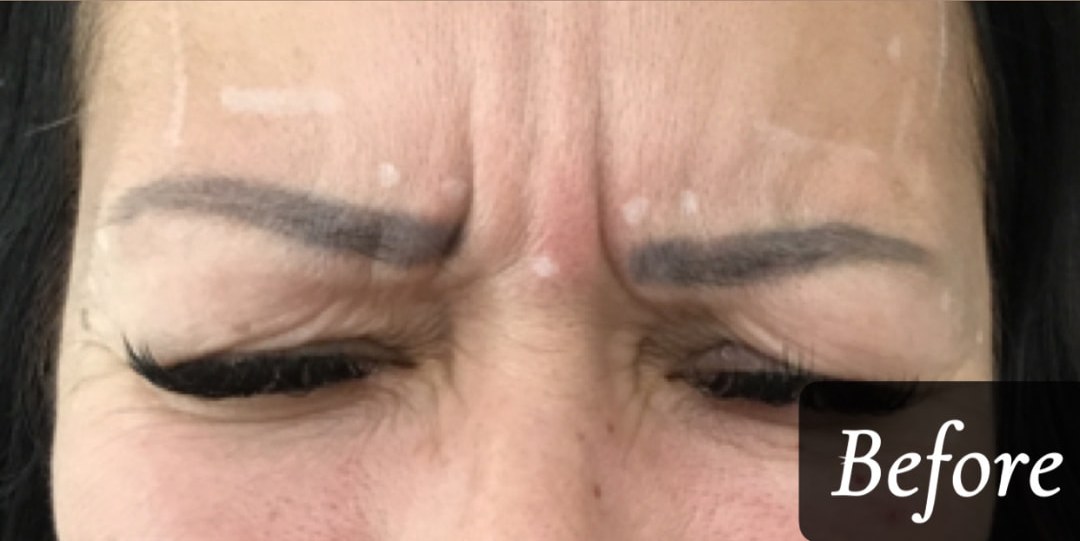 Before treatment