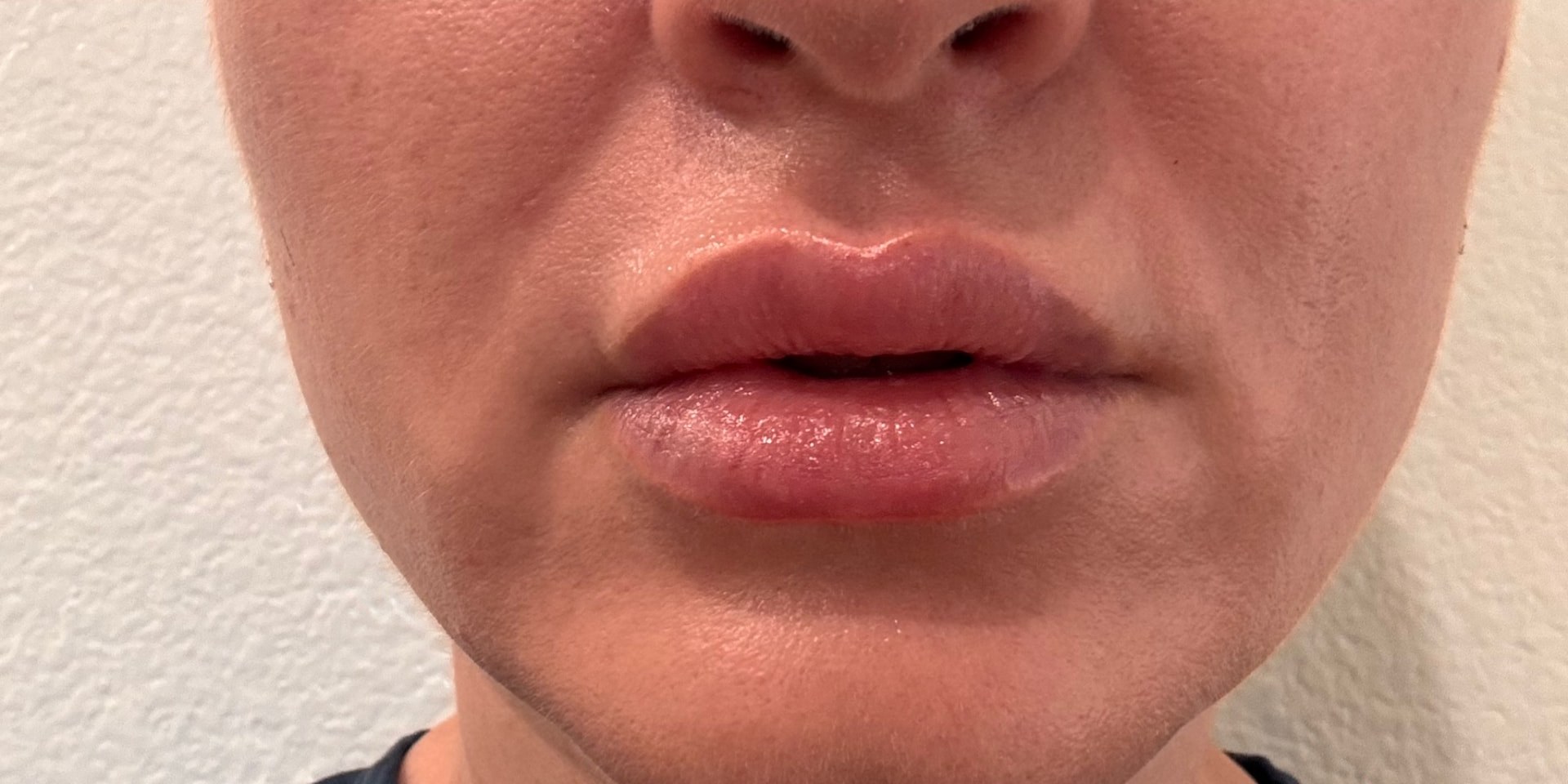 After treatment