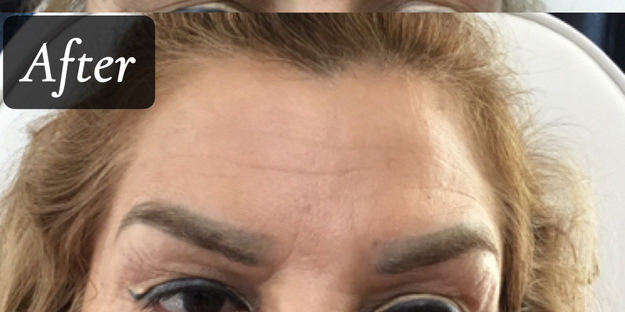 After treatment