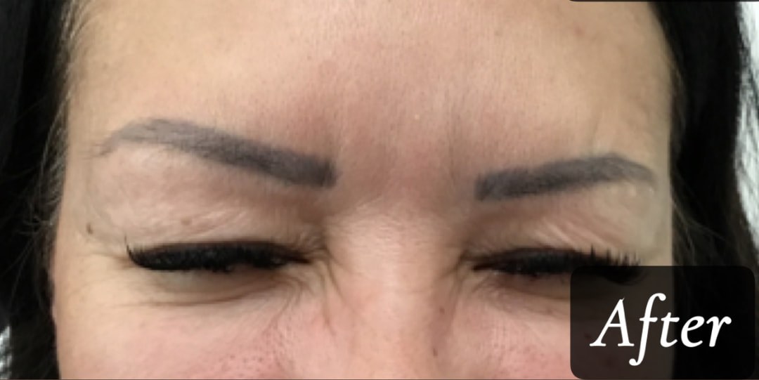 After treatment