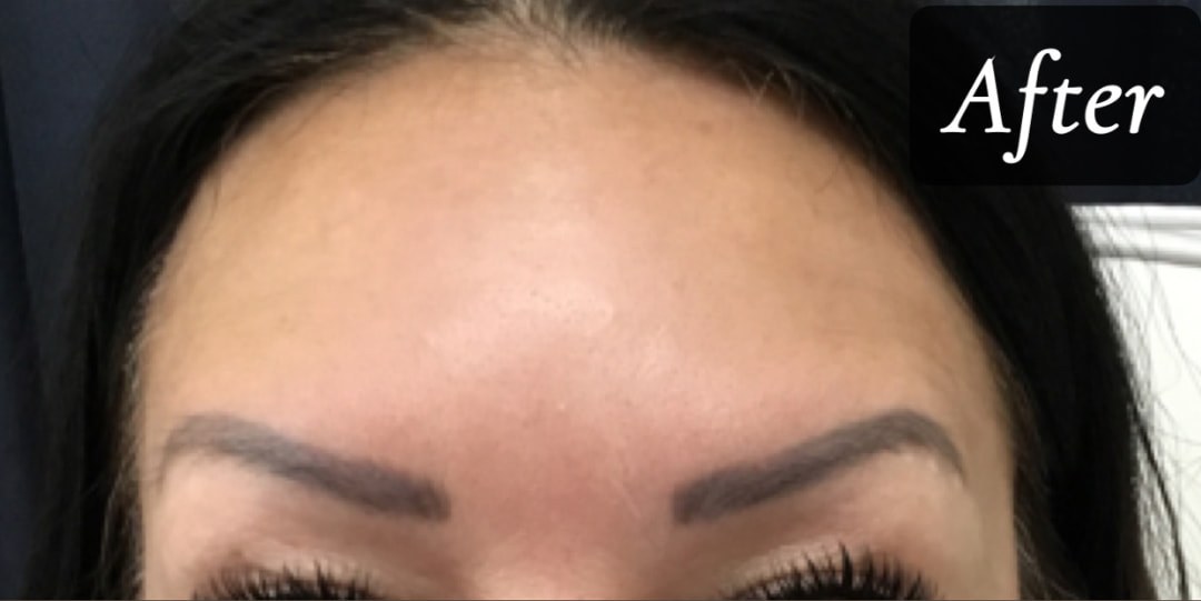 After treatment
